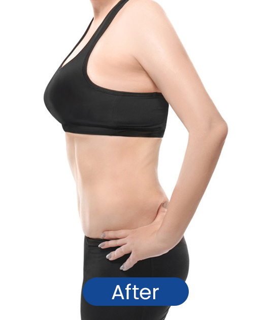 After full body sculpting result