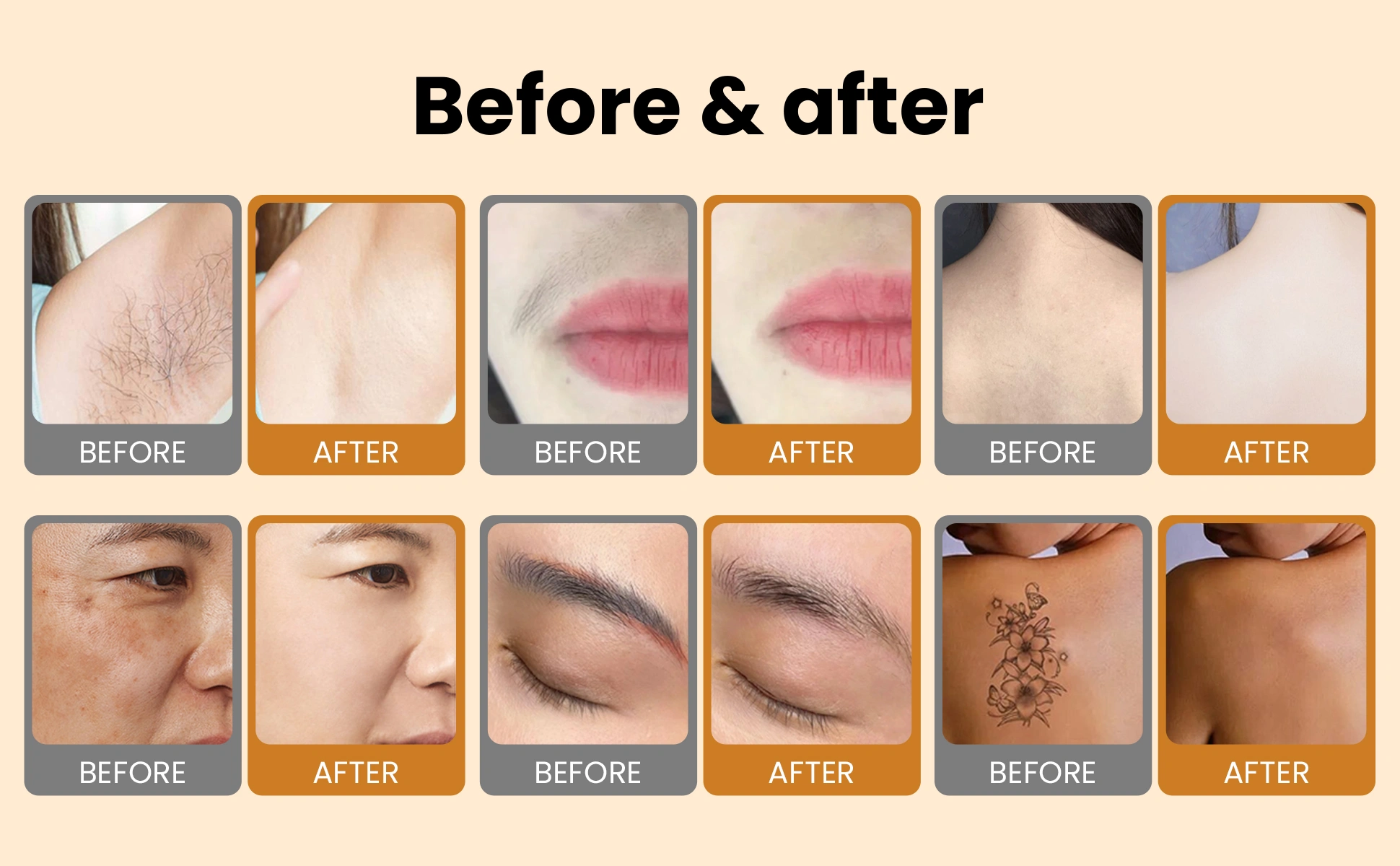 Before and After Results